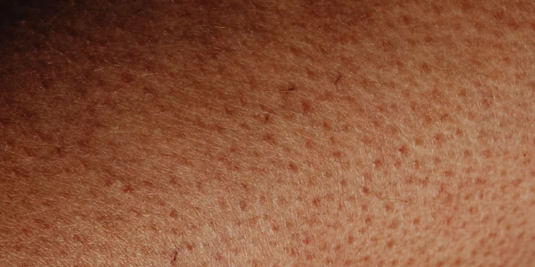 How can I naturally brighten dull skin at home?