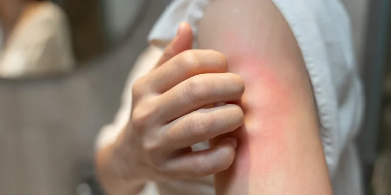 How can I prevent skin damage from pollution naturally?